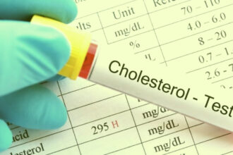 5 Buah Penurun Kolesterol Yang Disebut Dalam Al Qur'an